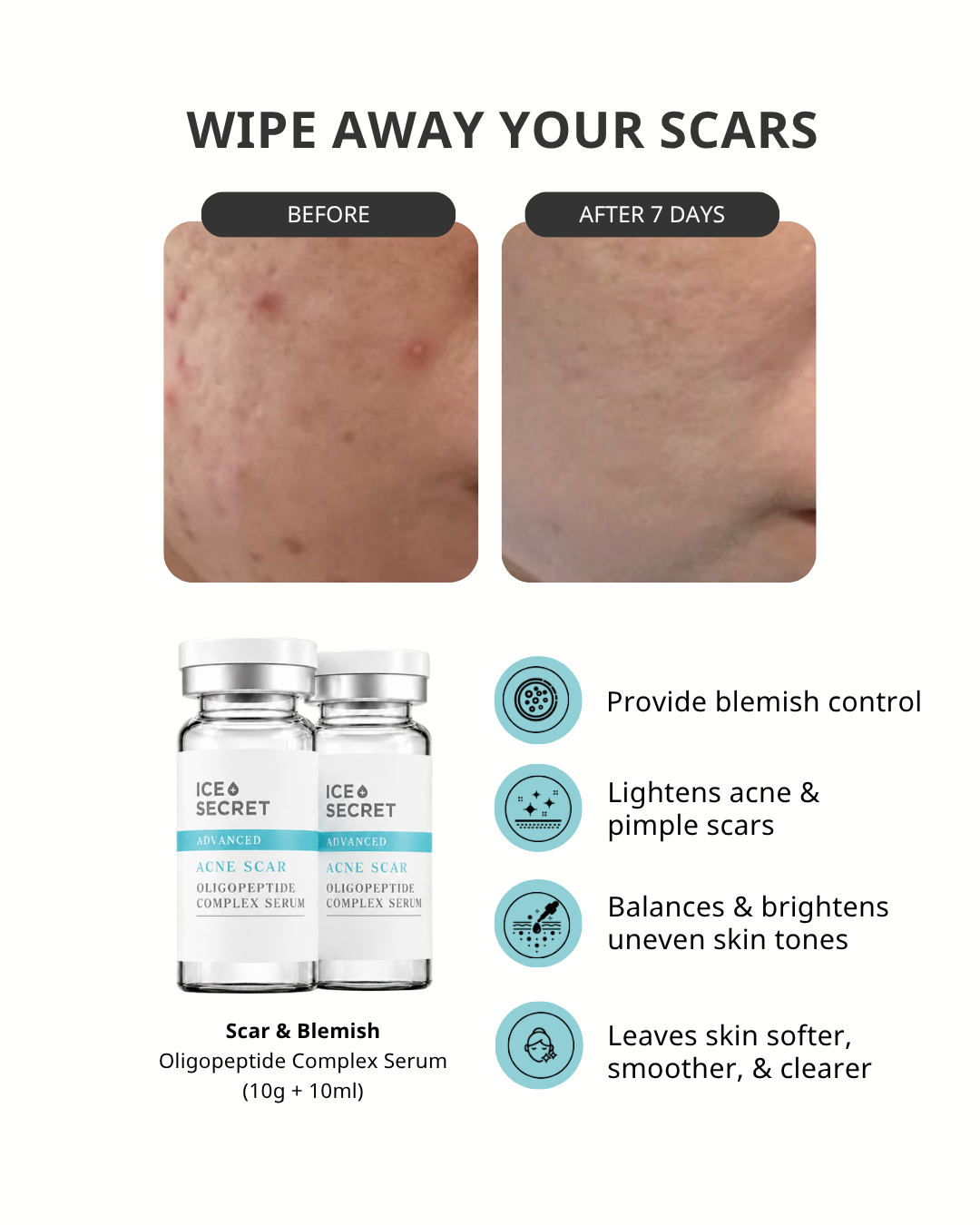 3_icesecret_infocard_acne_scar_complex_serum.png