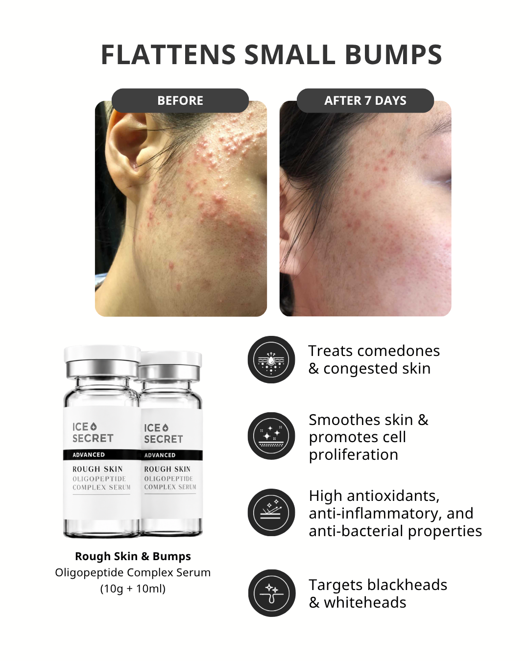 Rough Skin & Bumps Oligopeptide Complex Serum
