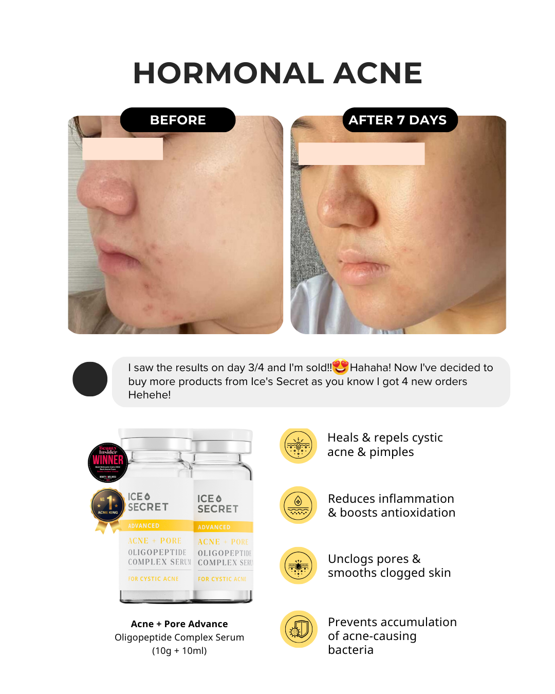 Acne Advance Kit