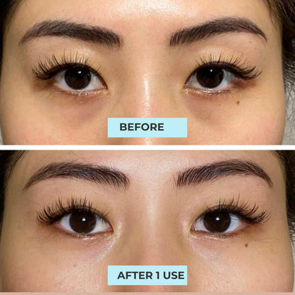 (FLASH SALES) Serum &amp; Eye Mask Kit: Best Eye Serum Advanced + Night Owl Eye Mask III