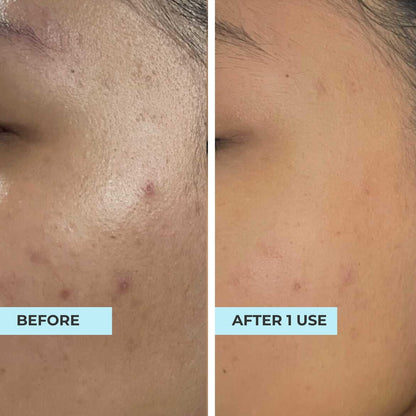 (FLASH SALES) Pore-Perfect Pair: Pore &amp; Glow + O2 Mask