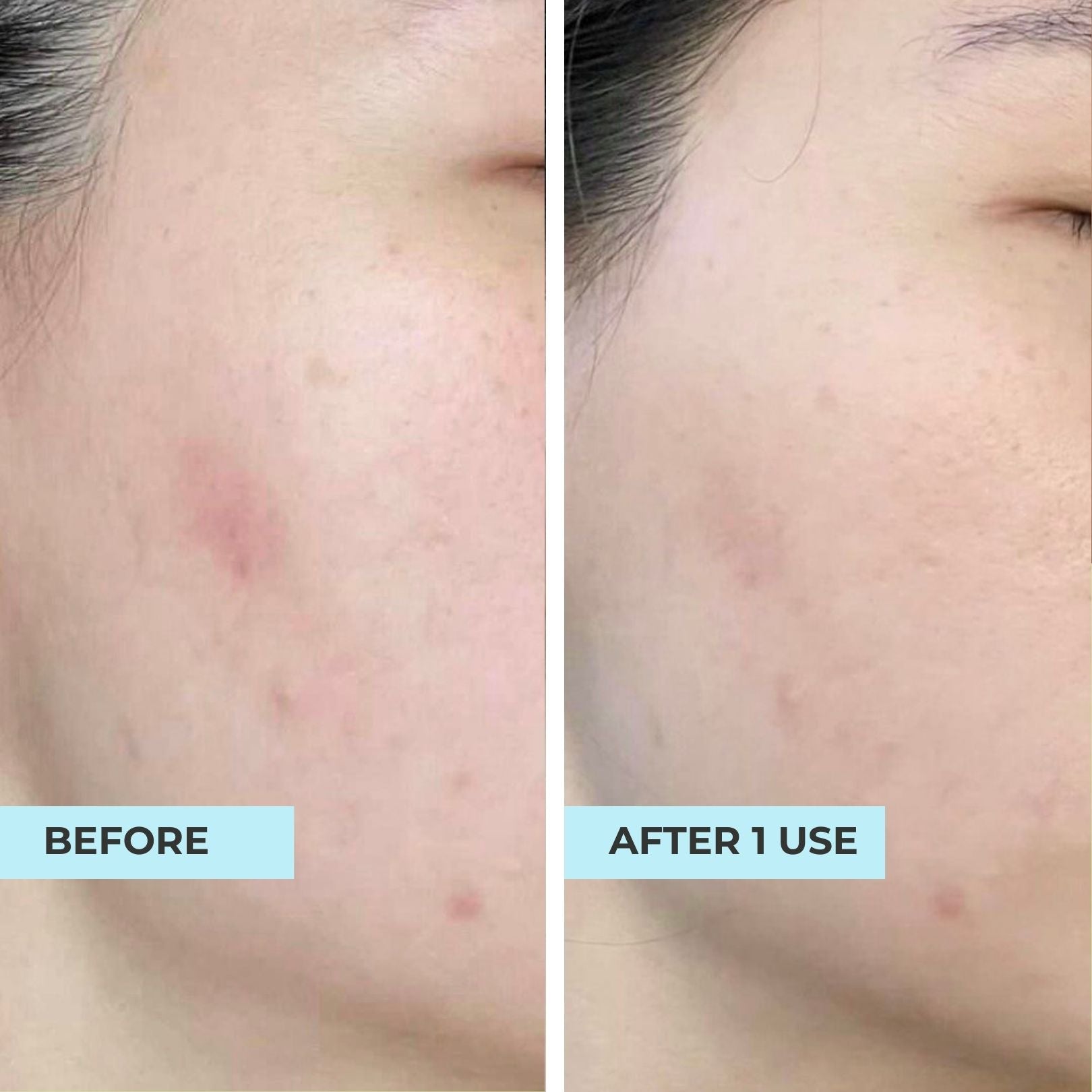 (FLASH SALES) Pore-Perfect Pair: Pore &amp; Glow + O2 Mask
