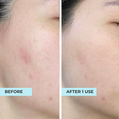 (FLASH SALES) Pore-Perfect Pair: Pore &amp; Glow + O2 Mask