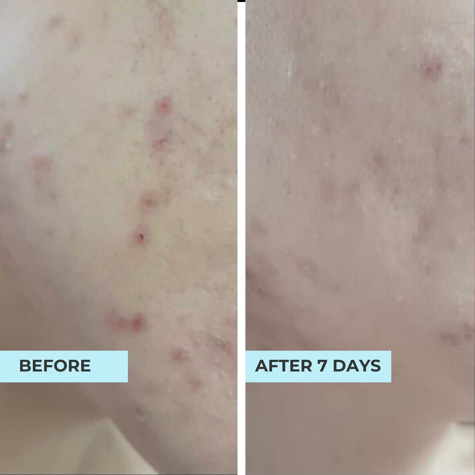 (FLASH SALES) Pore-Perfect Pair: Pore &amp; Glow + O2 Mask