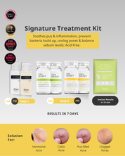 Acne Advance Kit