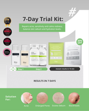 Acne Away Kit