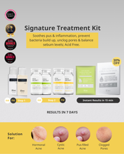 Acne Advance Kit