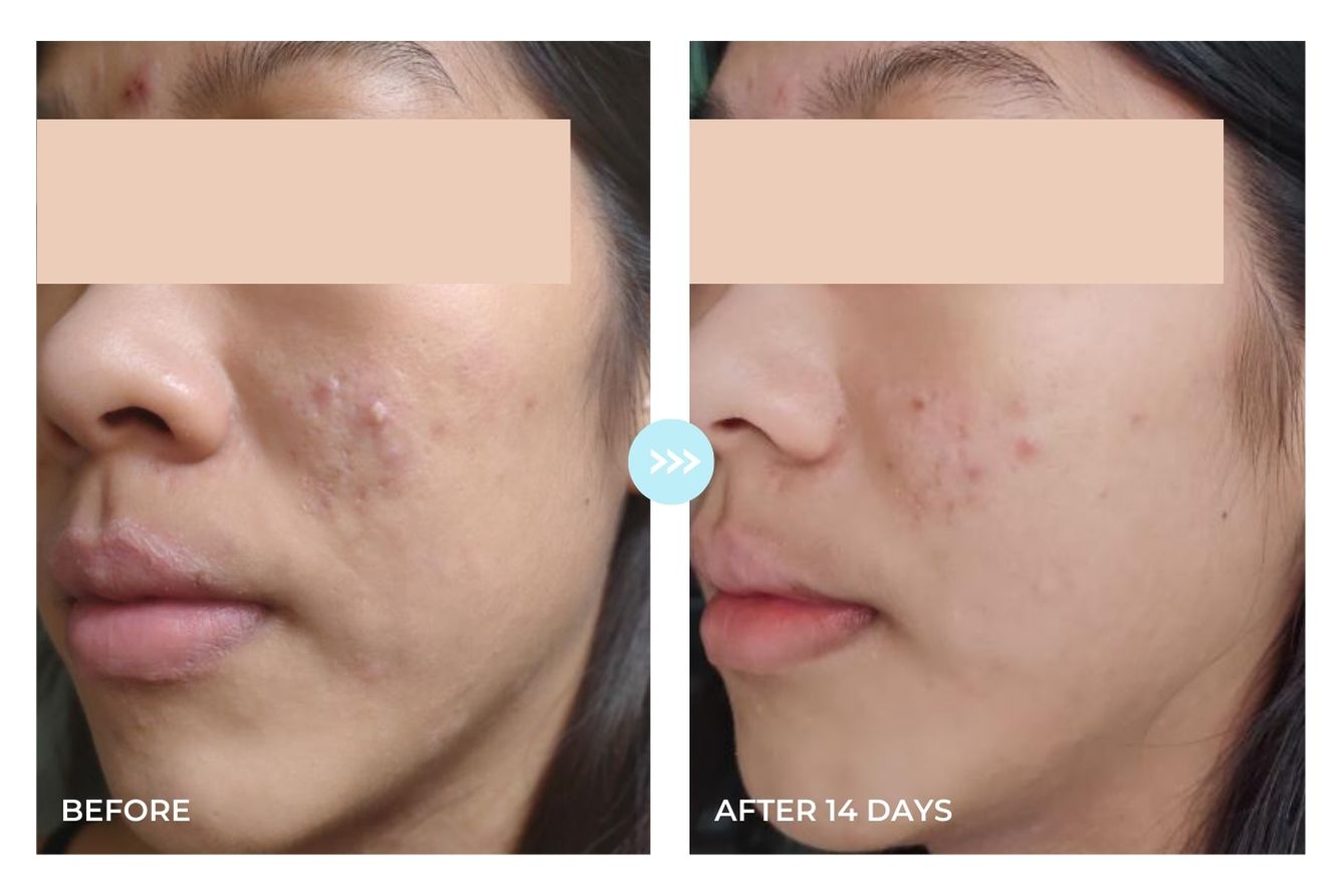 Before and after result 1