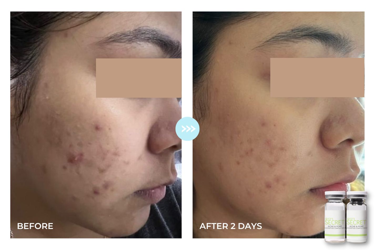 Before and after result 1
