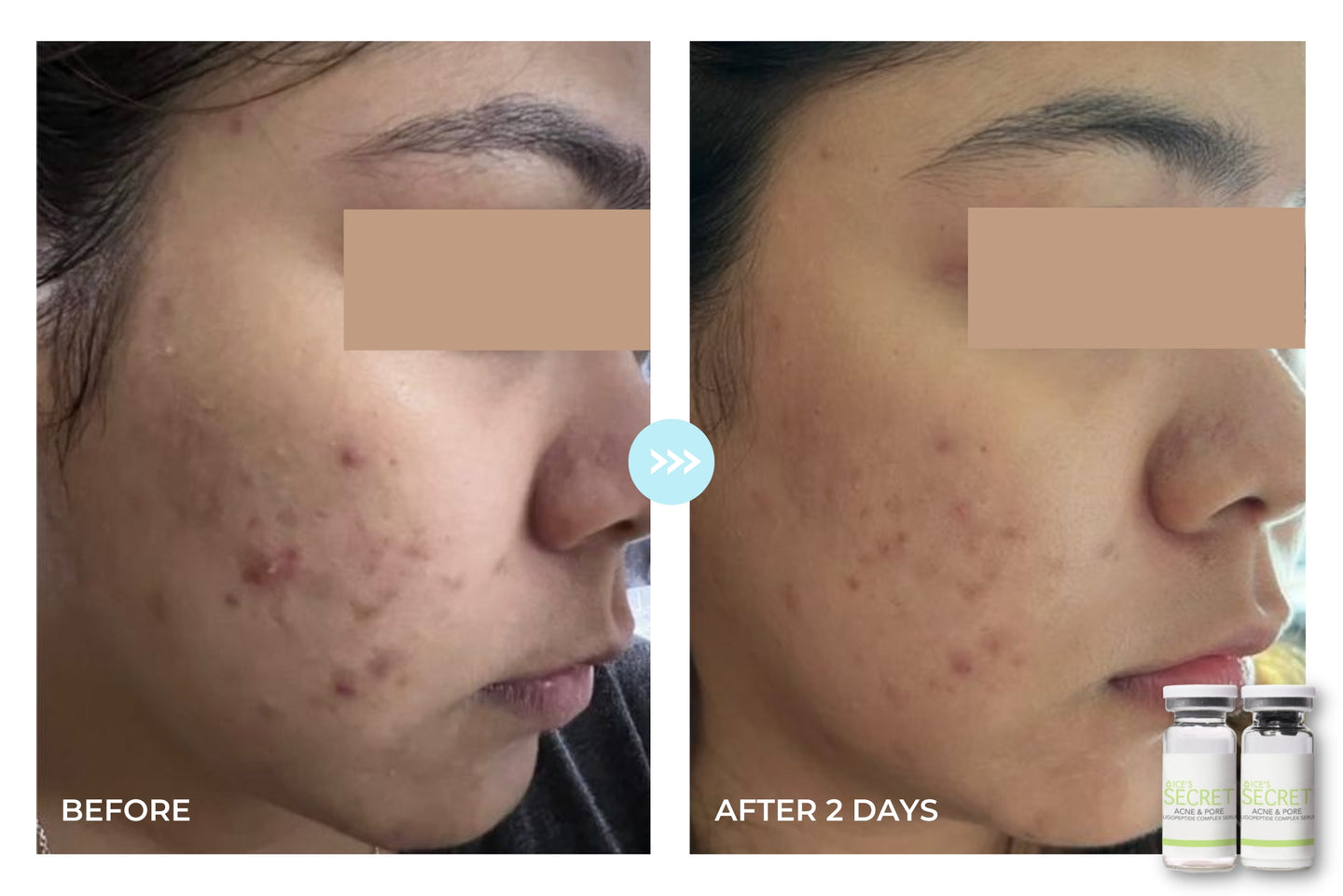 Before and after result 1