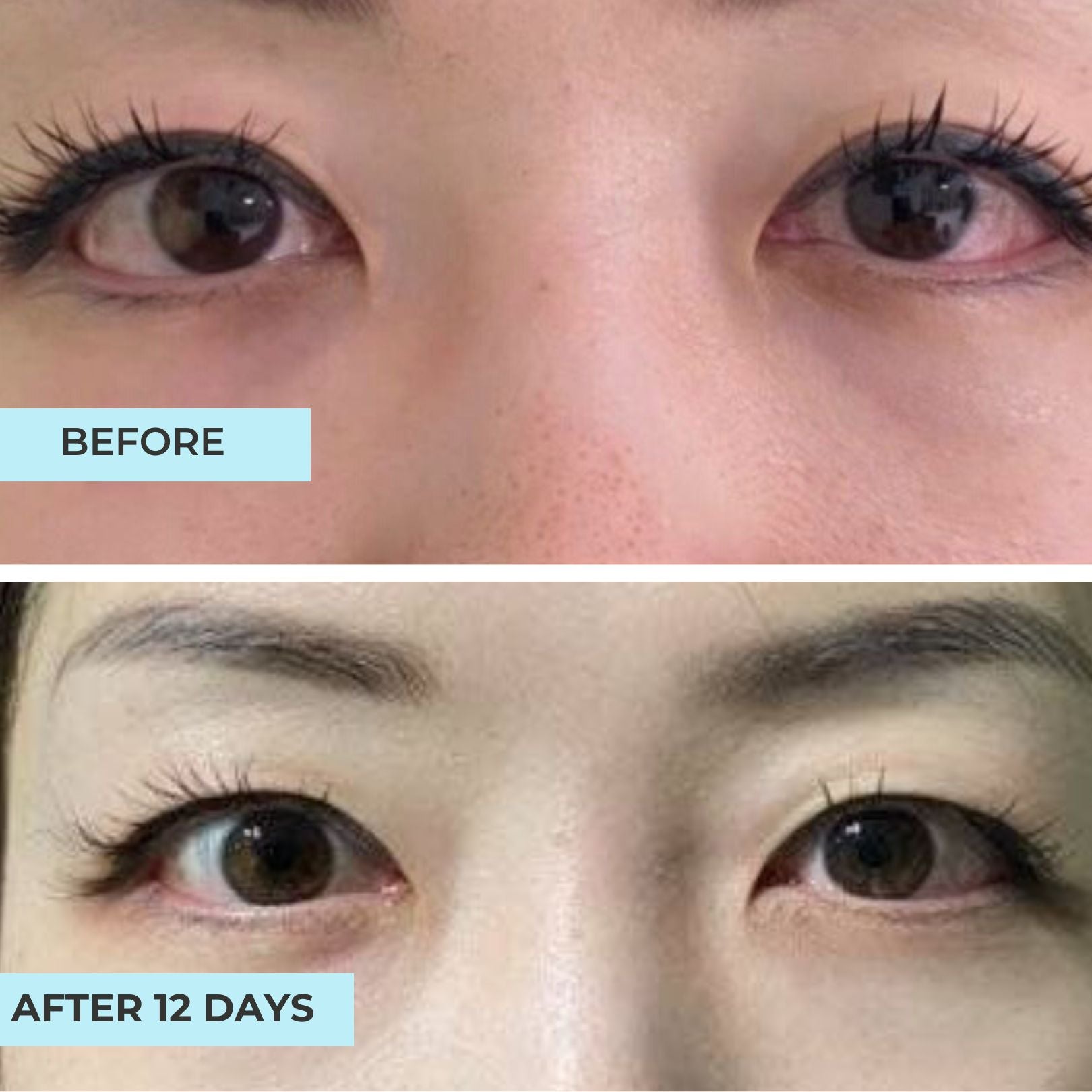 Depuff & Brightening Eye Relaxation Kit