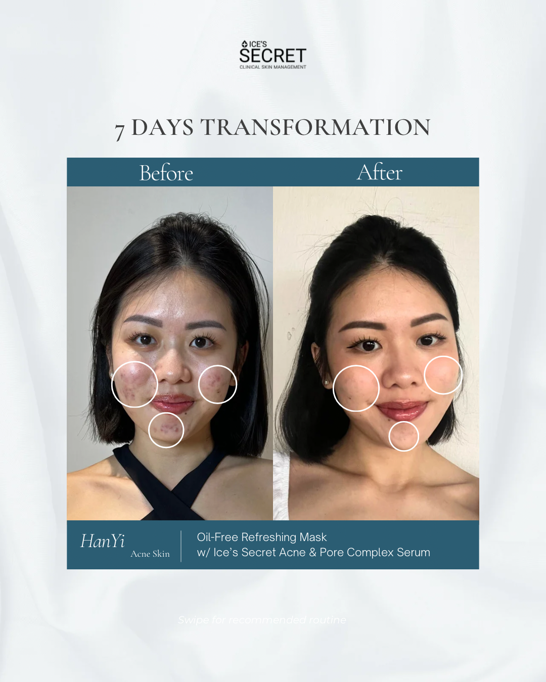 (CNY FLASH DEALS) 7-Day Skin Transformation Kit