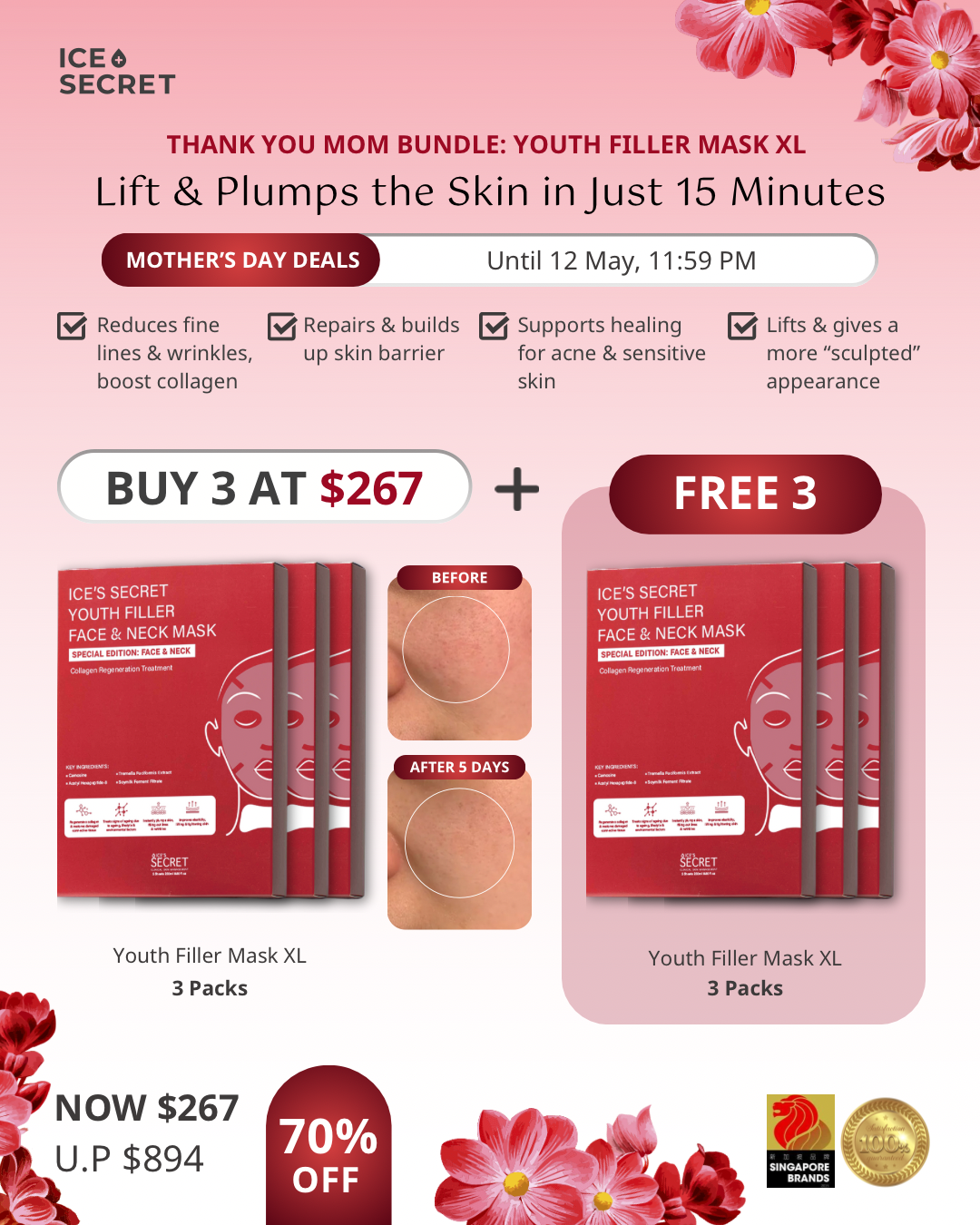 (FLASH DEALS) Thank you MOM XL Youth Filler Mask Bundle