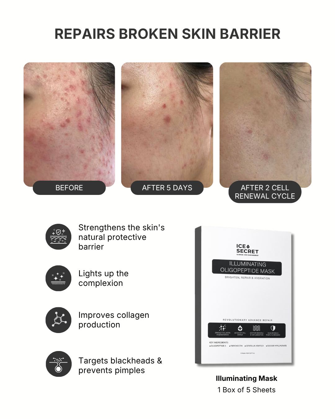 Illuminating Mask Bundle