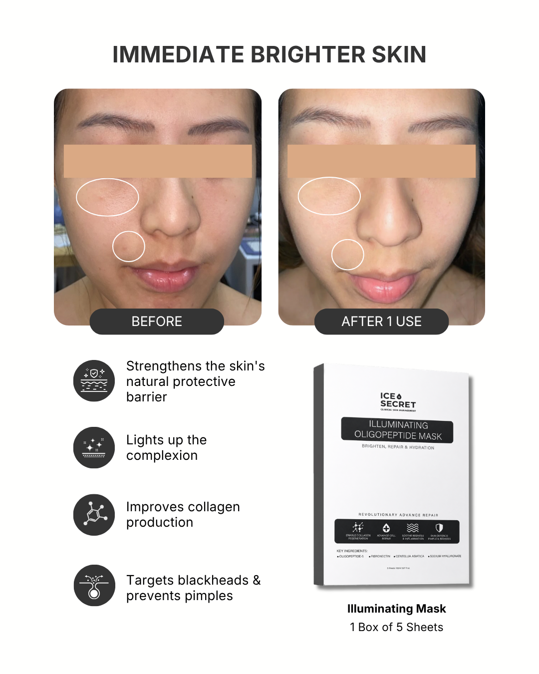 Illuminating Mask Bundle