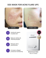 (5 in 1) Sensitive & Redness + Acne & Pore (Acne-Prone, Oily Skin & Pores)