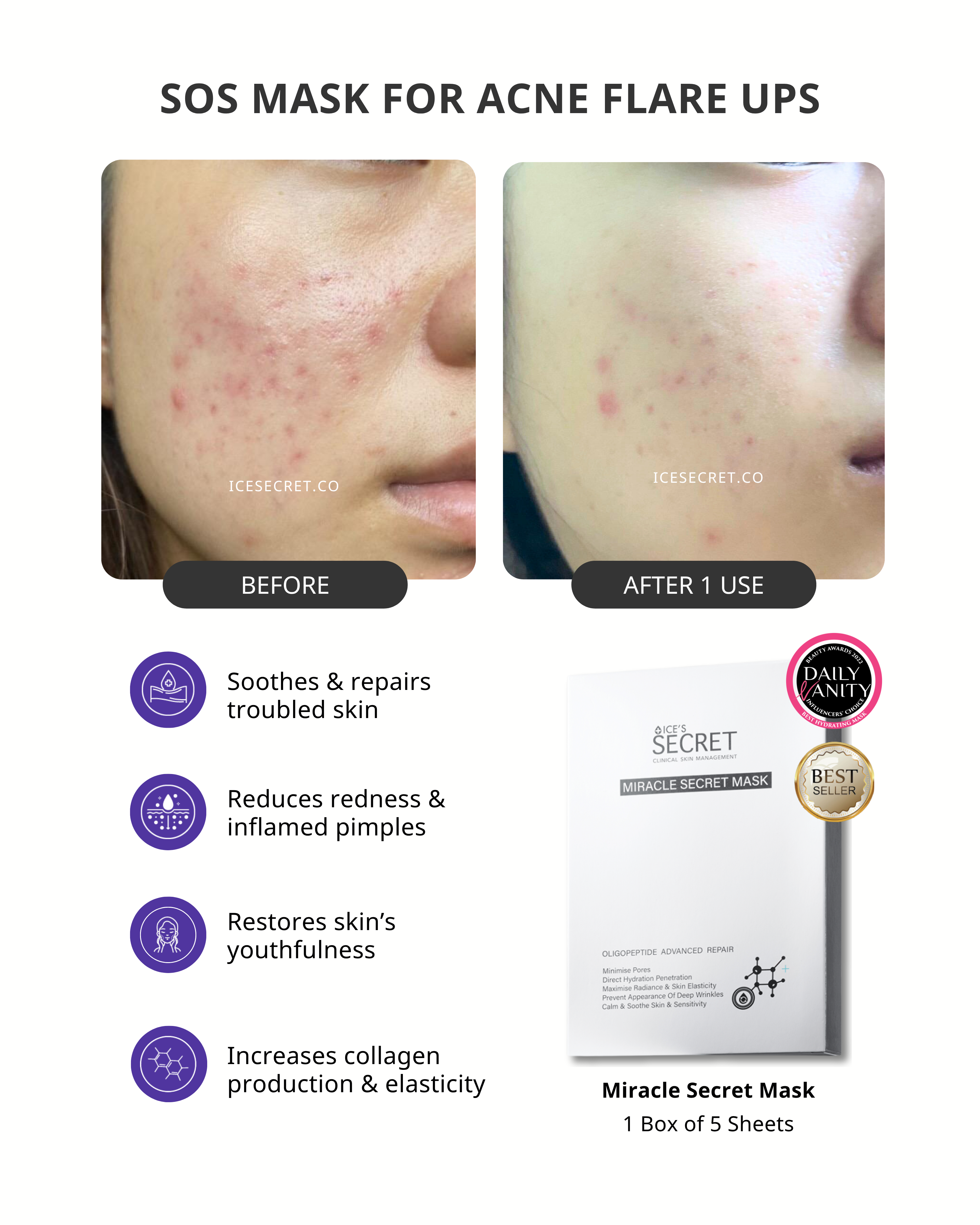 (5 in 1) Sensitive & Redness + Acne & Pore (Acne-Prone, Oily Skin & Pores)