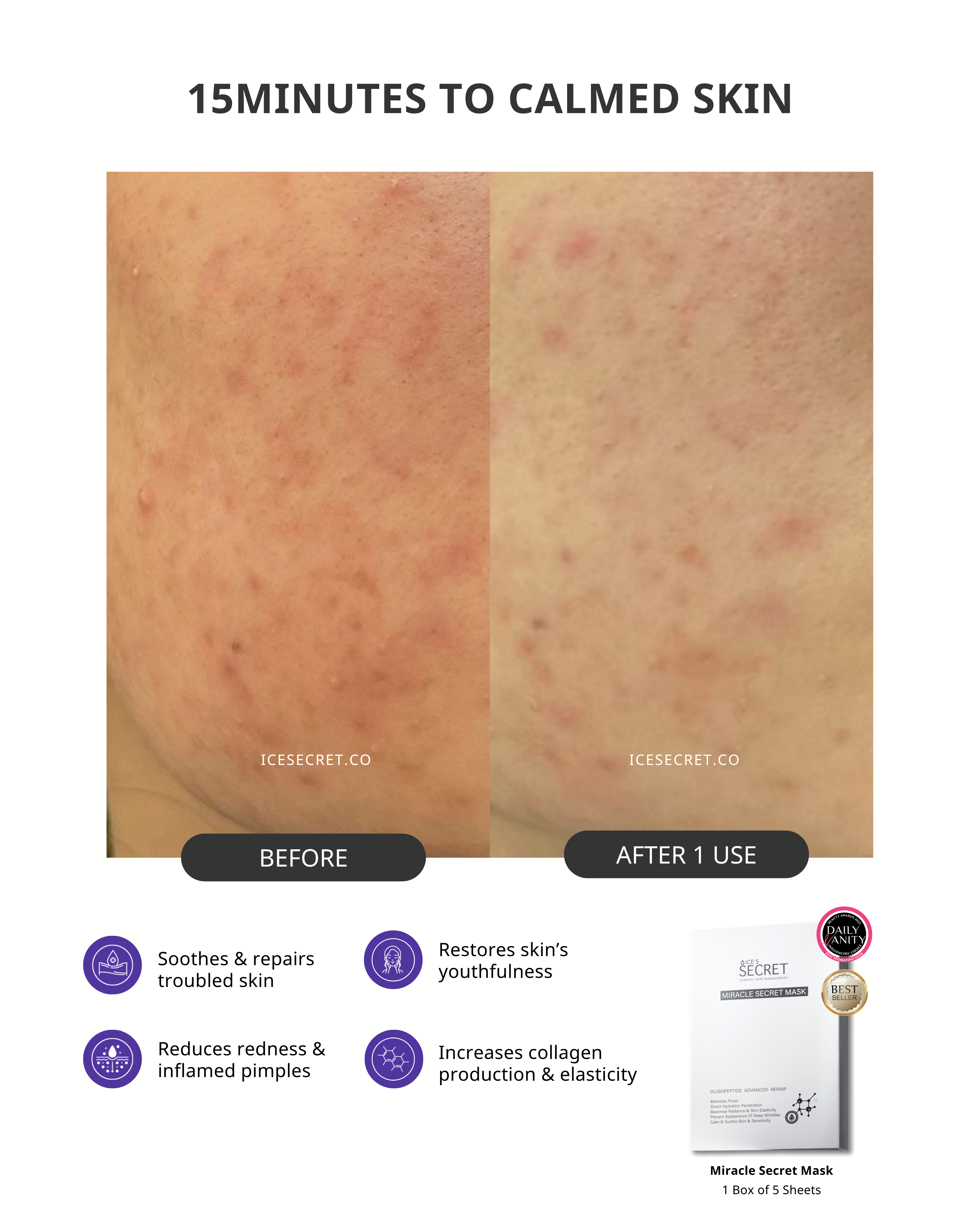 (5 in 1) Sensitive & Redness + Acne & Pore (Acne-Prone, Oily Skin & Pores)
