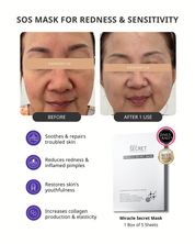 (5 in 1) Sensitive & Redness + Acne & Pore (Acne-Prone, Oily Skin & Pores)