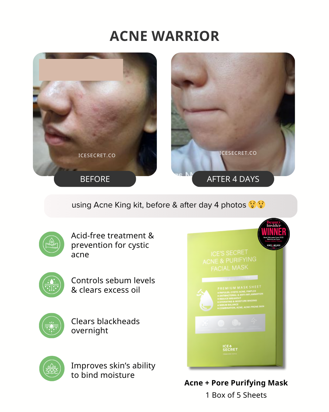 Acne Advance Kit