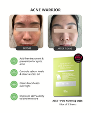 Acne Advance Kit