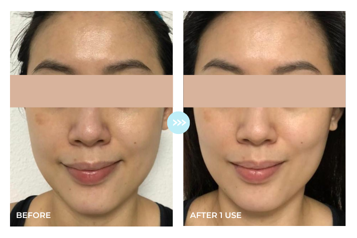 Before and after result 1