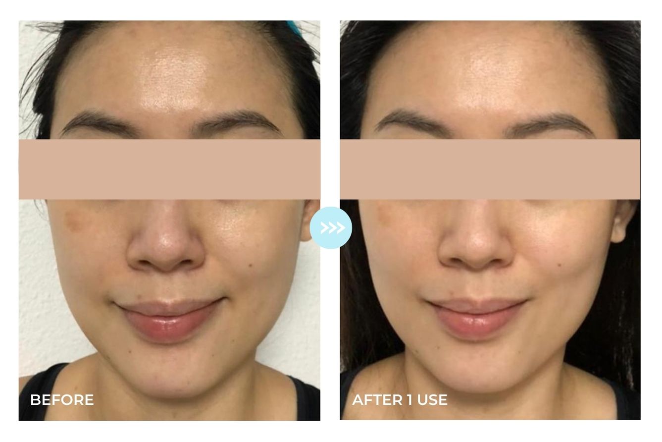 Before and after result 5