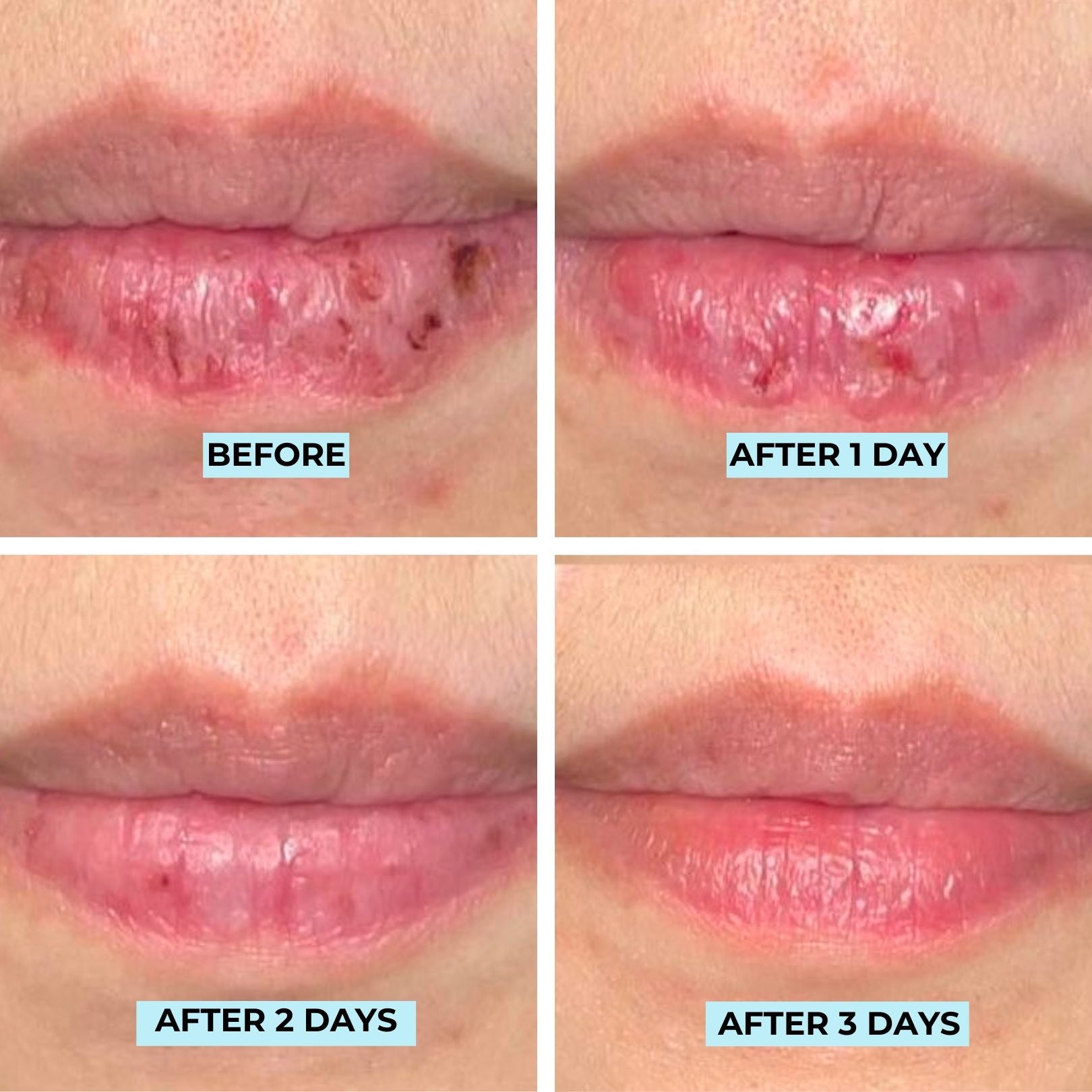 Youth Filler Lip Mask & Gloss