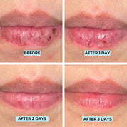 Youth Filler Lip Mask & Gloss