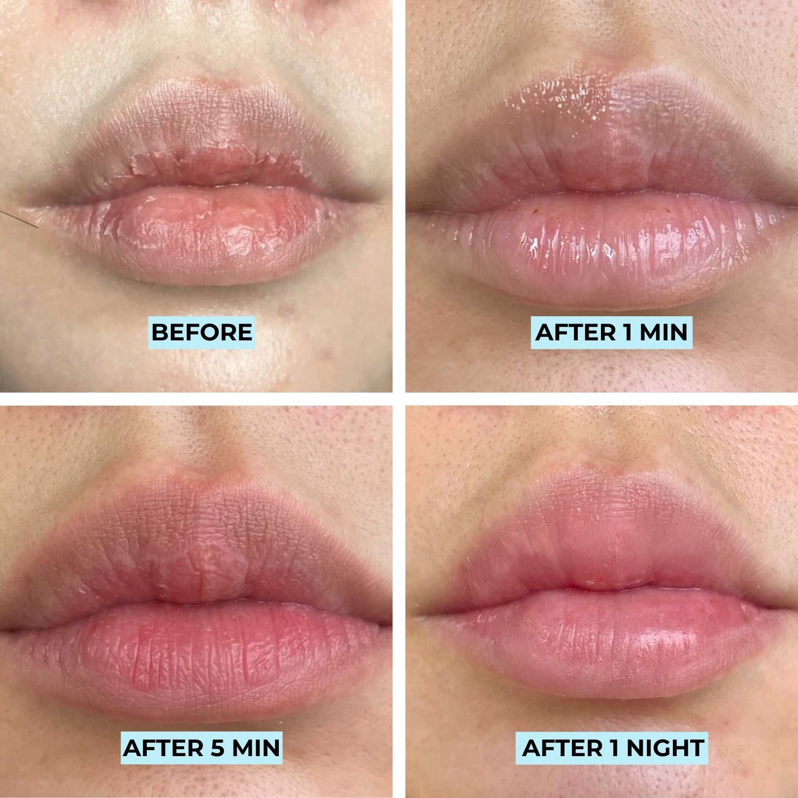 Youth Filler Lip Mask & Gloss