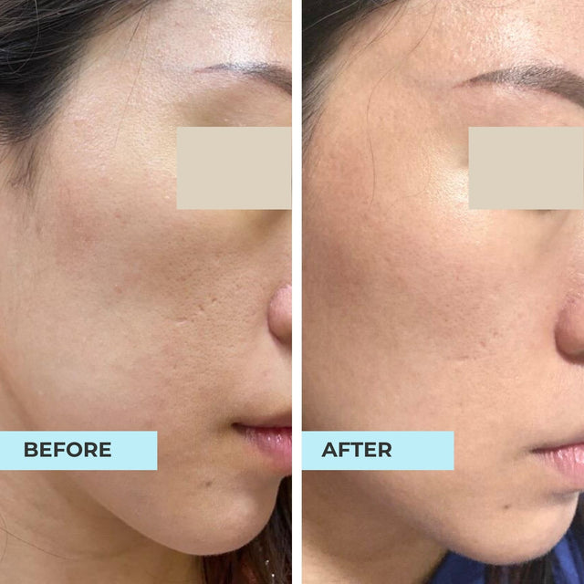 Customer result photo