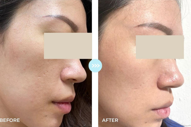 Customer result photo