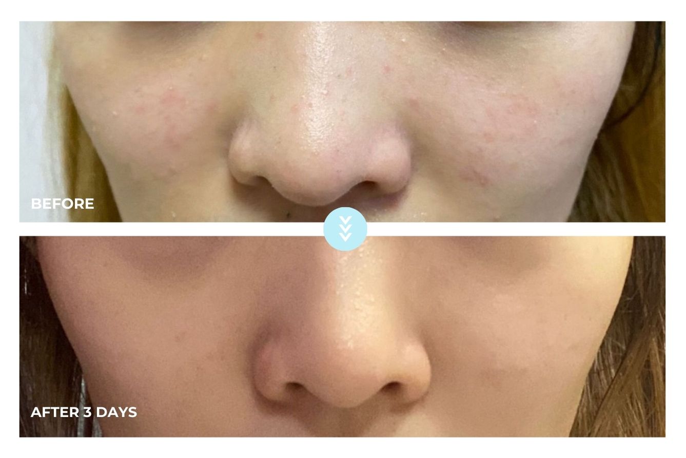 AquaGlow Peptide Mask Repair bundle B