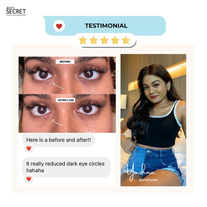 (FLASH SALES) Serum &amp; Eye Mask Kit: Best Eye Serum Advanced + Night Owl Eye Mask III
