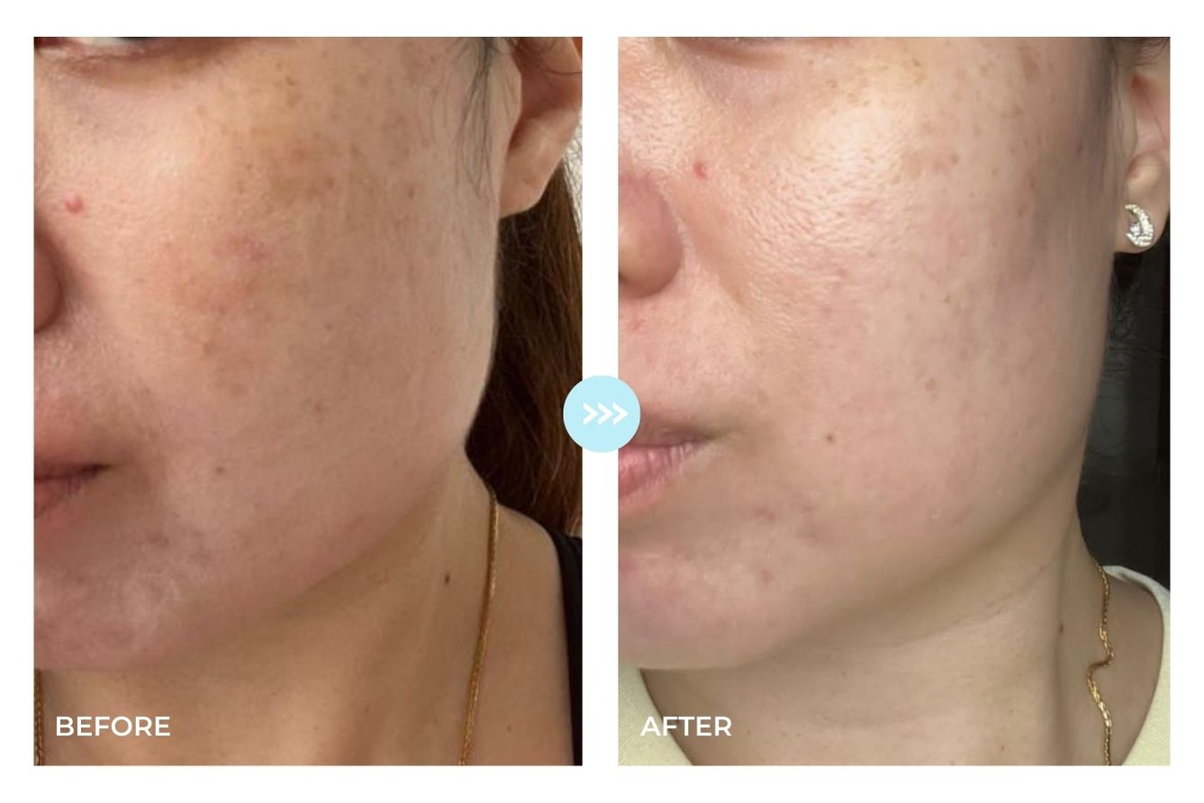 (XMAS DEALS) Signature: 2-in-1 Make Up & Gentle Cleansing Set 100ML