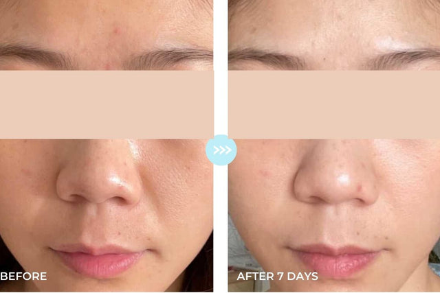 Customer result photo