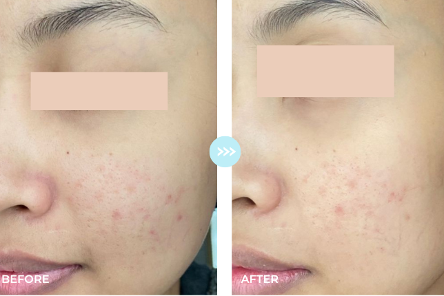 Before and after result 1