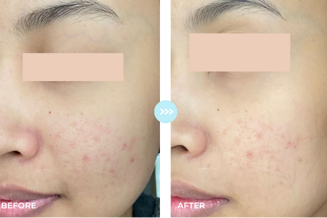 Customer result photo