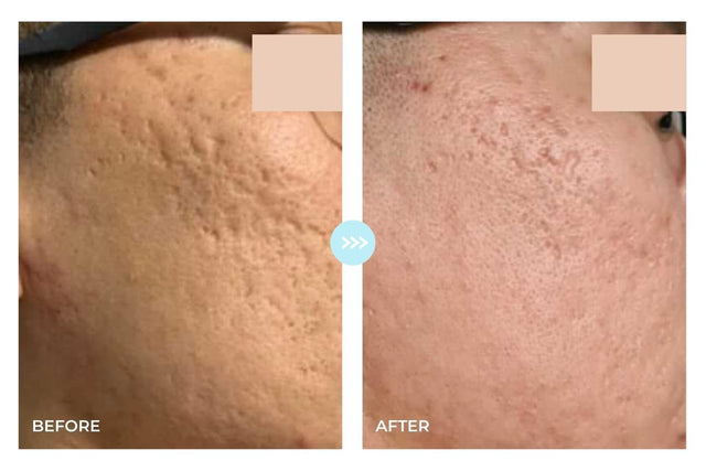 Customer result photo