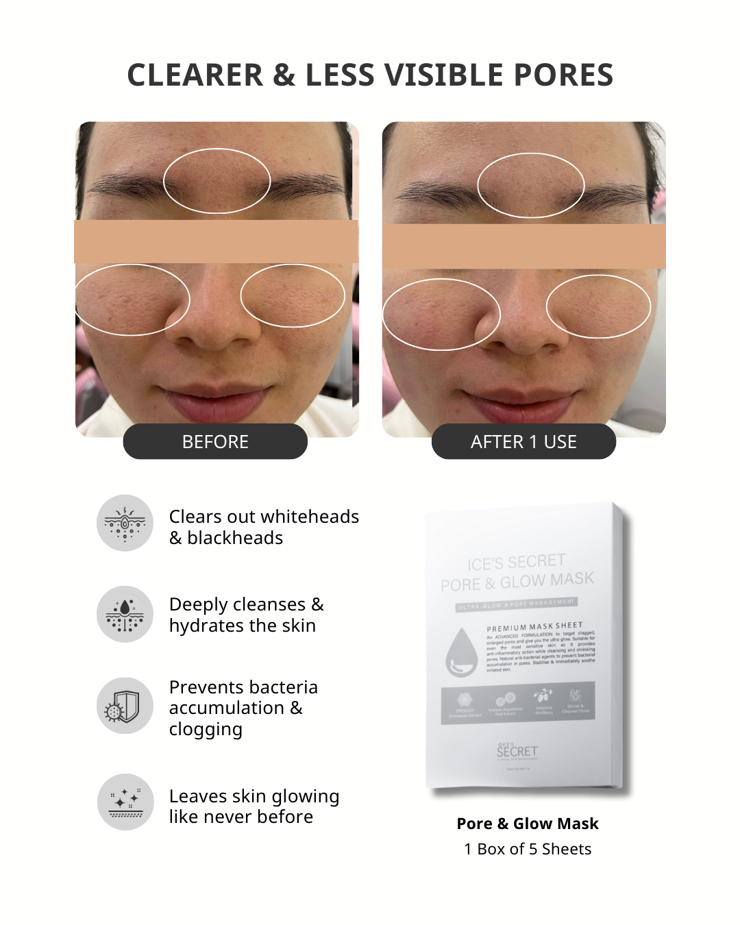 (Xmas Special) Mix & Match Mask Bundle