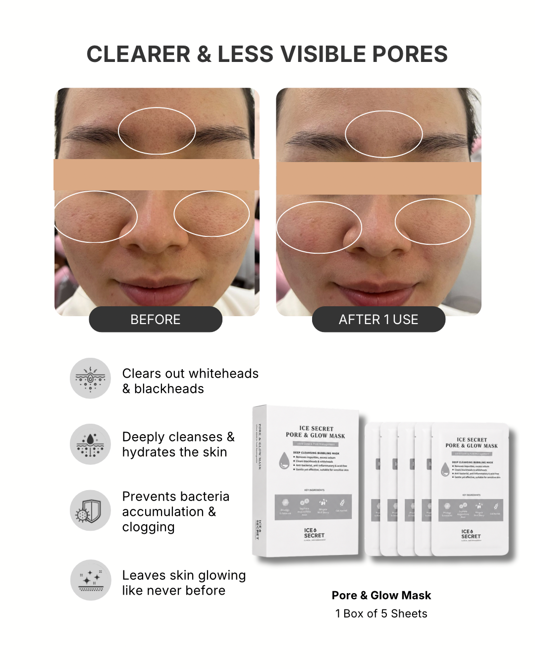 Pore&glow ice secret before after Oily skin black head 