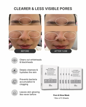 Pore&glow ice secret before after Oily skin black head 