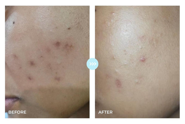 Customer result photo