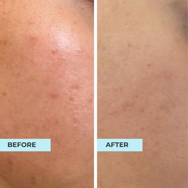 Customer result photo
