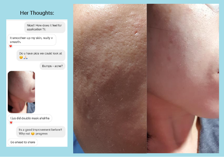 BEST SELLER: Smooth Skin, Brightening Kit