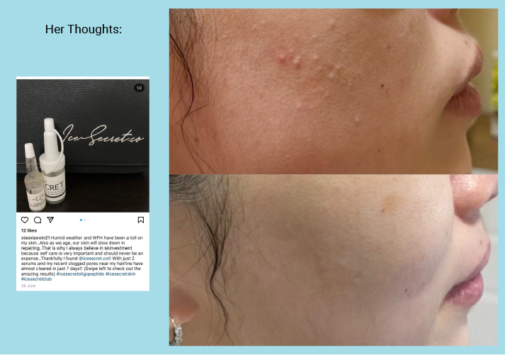 BEST SELLER: Smooth Skin, Brightening Kit