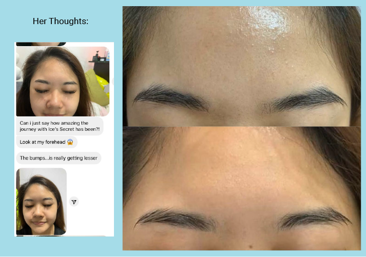 BEST SELLER: Smooth Skin, Brightening Kit