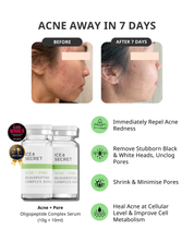 (5 in 1) Sensitive & Redness + Acne & Pore (Acne-Prone, Oily Skin & Pores)