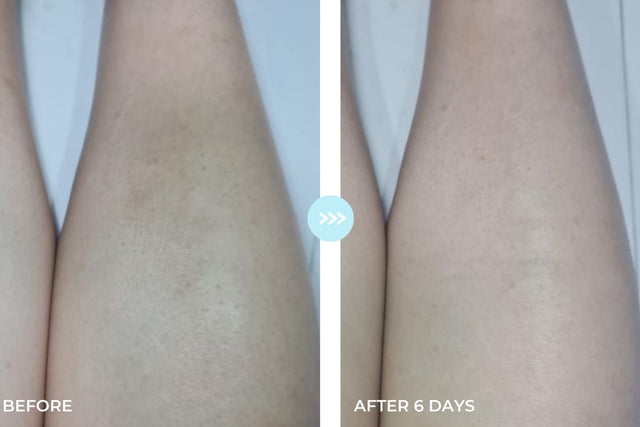 Customer result photo