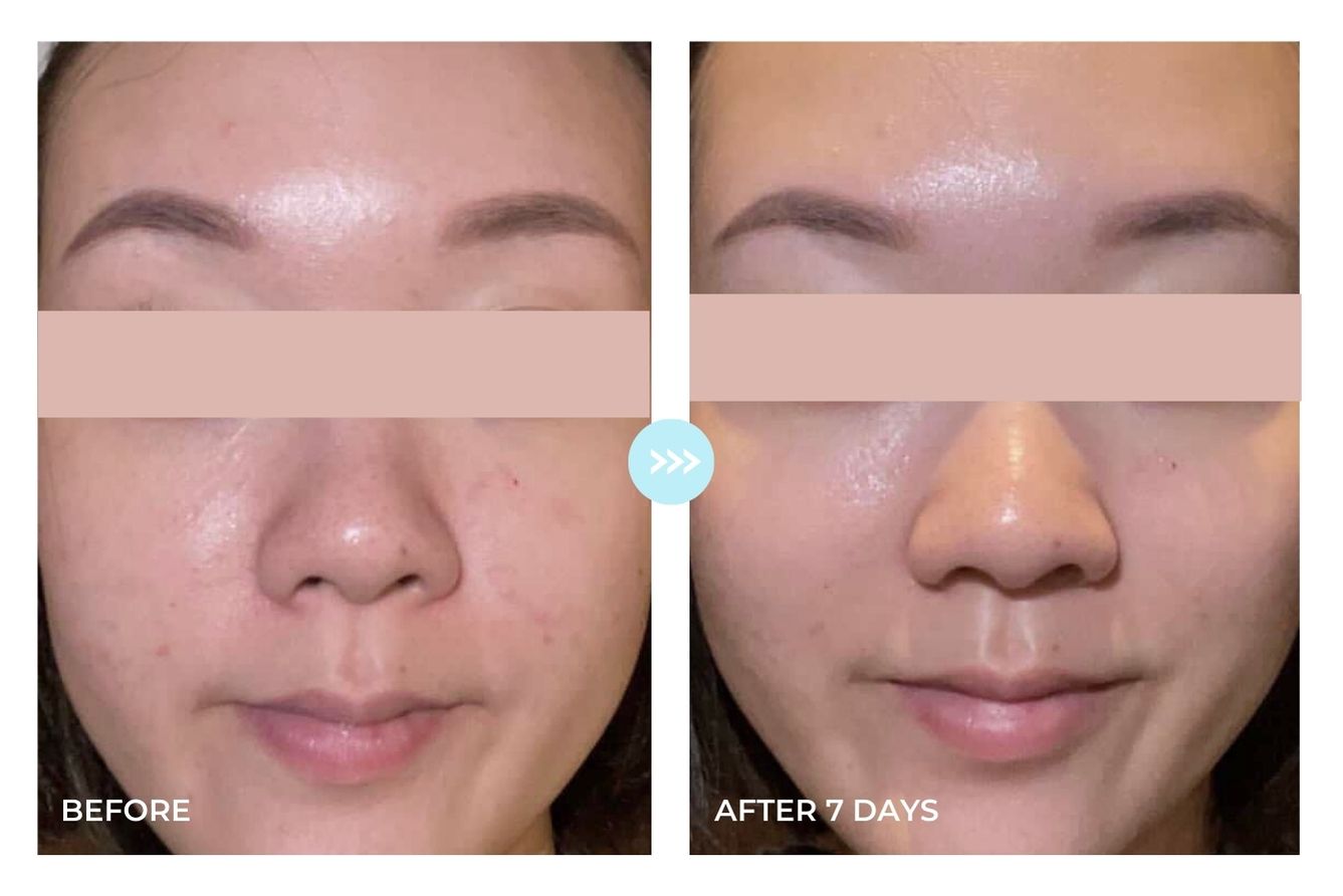 Before and after result 3